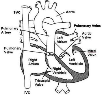 down syndrome diagram