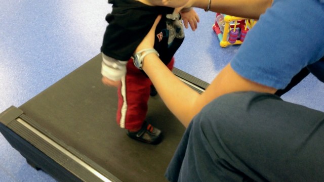 learning to walk treadmill baby therapy down syndrome