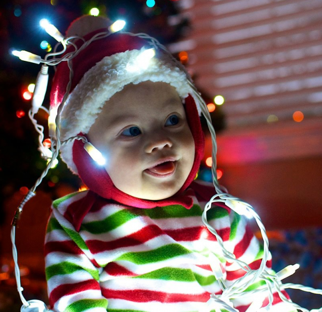 baby down syndrome future bright christmas cute