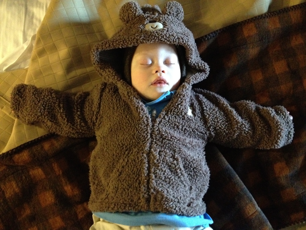 baby-down-syndrome-bear-coat-1-year-old