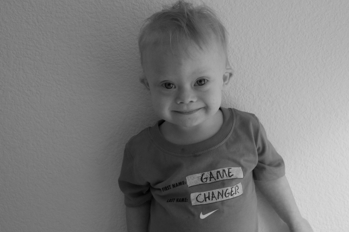 cute smiling boy with down syndrome