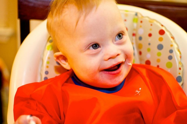 first-birthday-one-year-old-down-syndrome-18