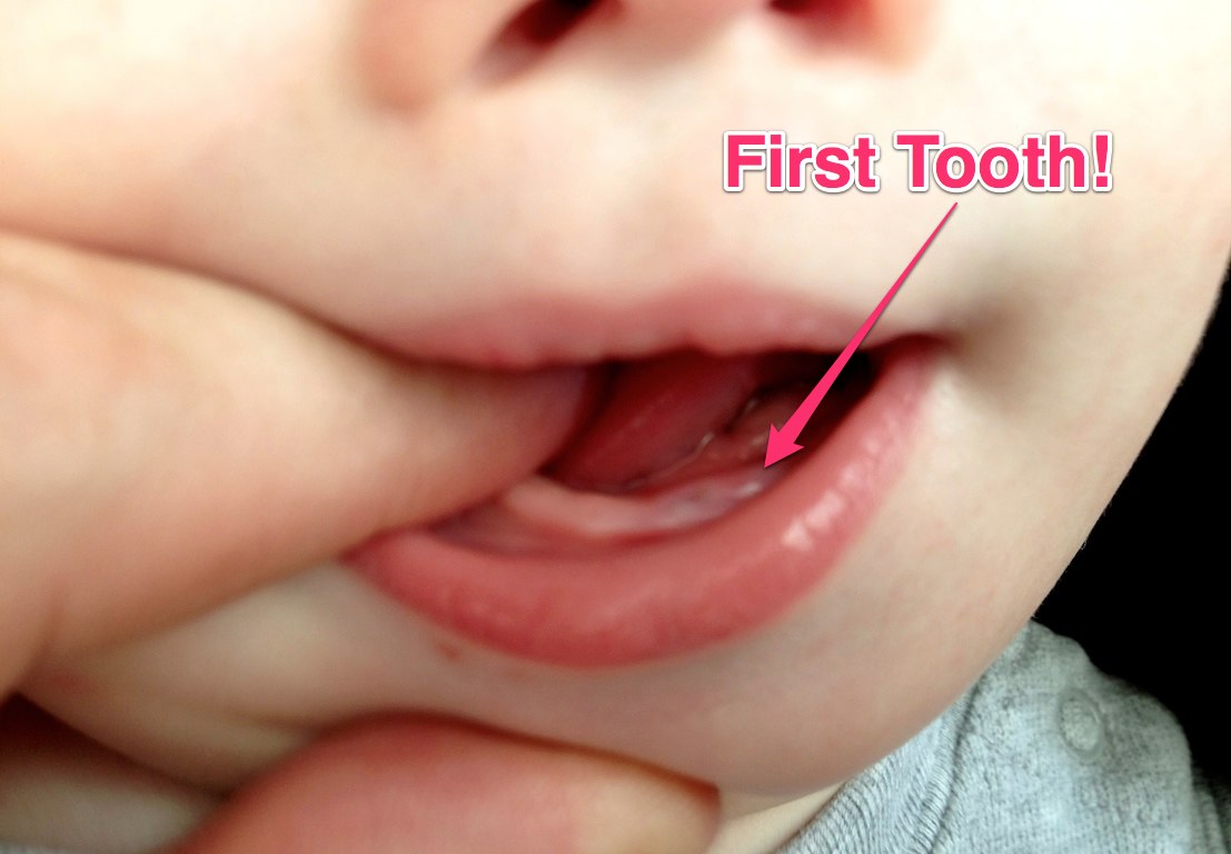 Milestone Alert: Our Baby's First Tooth!