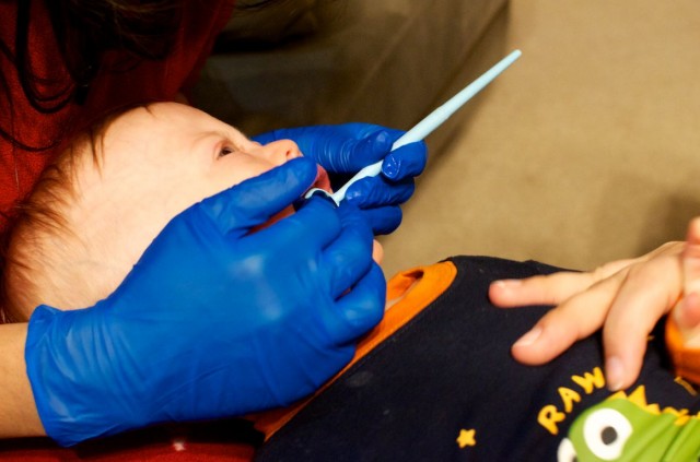 down syndrome baby dentist examination