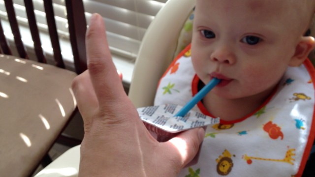 baby with down syndrome learning how to suck from a straw