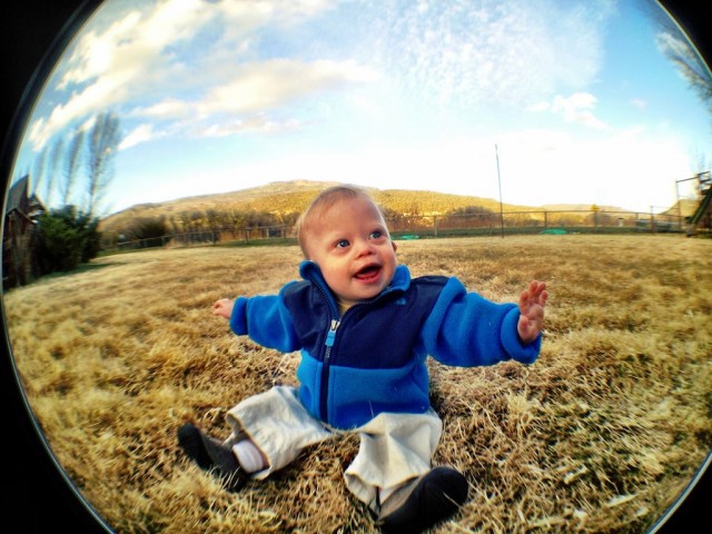 baby-down-syndrome-special-needs-fish-eye-lens 4