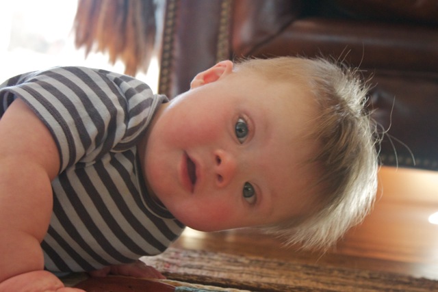 infant spasms down syndrome diagnosis
