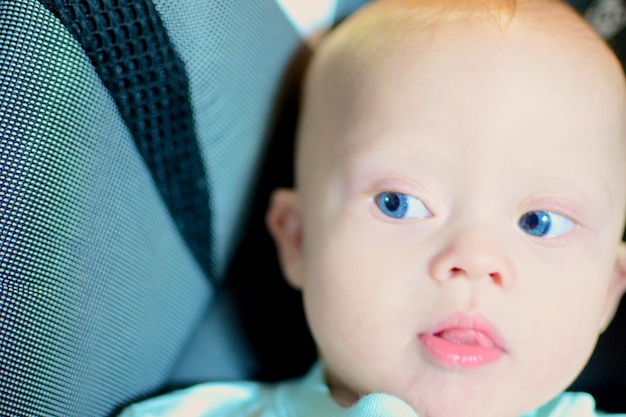 Our son was born with down syndrome and blue eyes