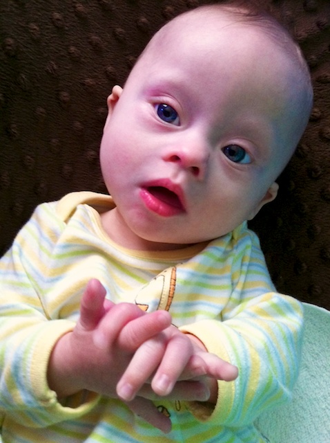 down-syndrome-babies 2