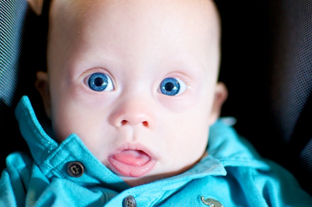 Our son born with Down Syndrome has amazing eyes