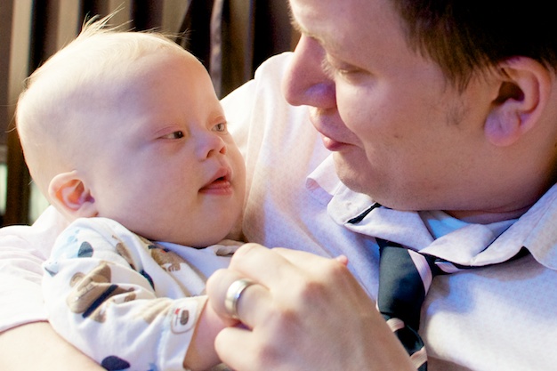 father and son picture baby with down downs syndrome