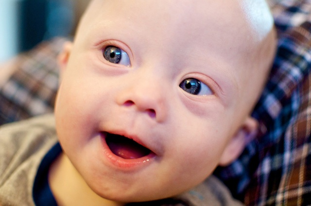 down syndrome cute baby boy