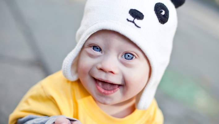 cute down syndrome baby