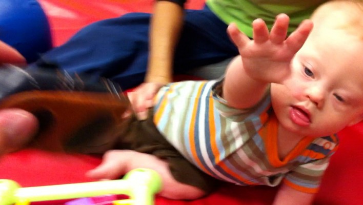 baby with down syndrome reaching out therapy