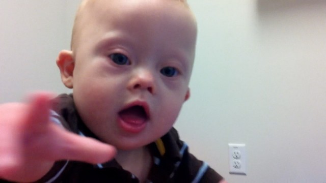 baby with down syndrome at physical therapy