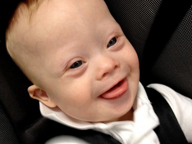 down syndrome kid smiling laughing