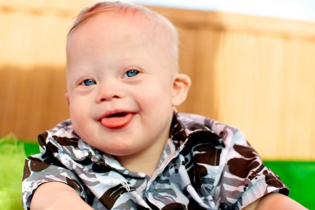 happy smiling baby down syndrome