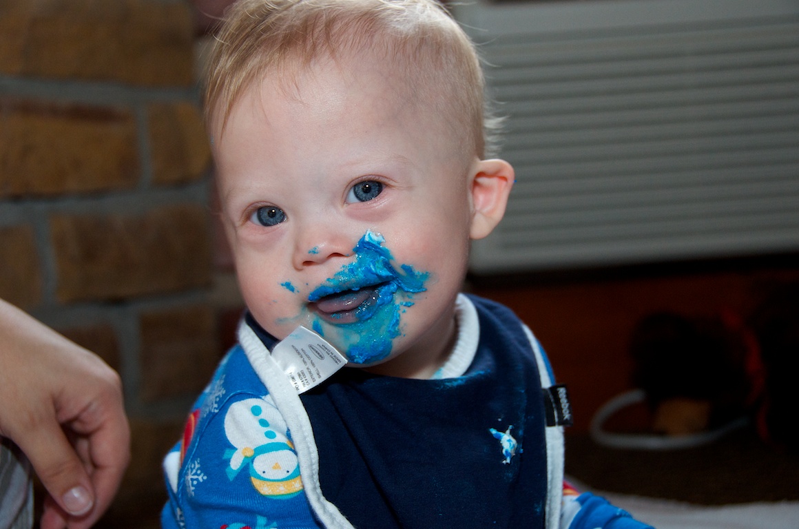 first-birthday-party-smash-cake-down-syndrome-baby-blue-eyes 1
