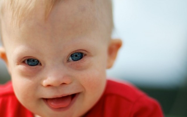 rocky moutains colorado down syndrome boy child