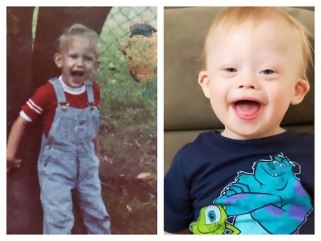 toddler with down syndrome looks like his parents
