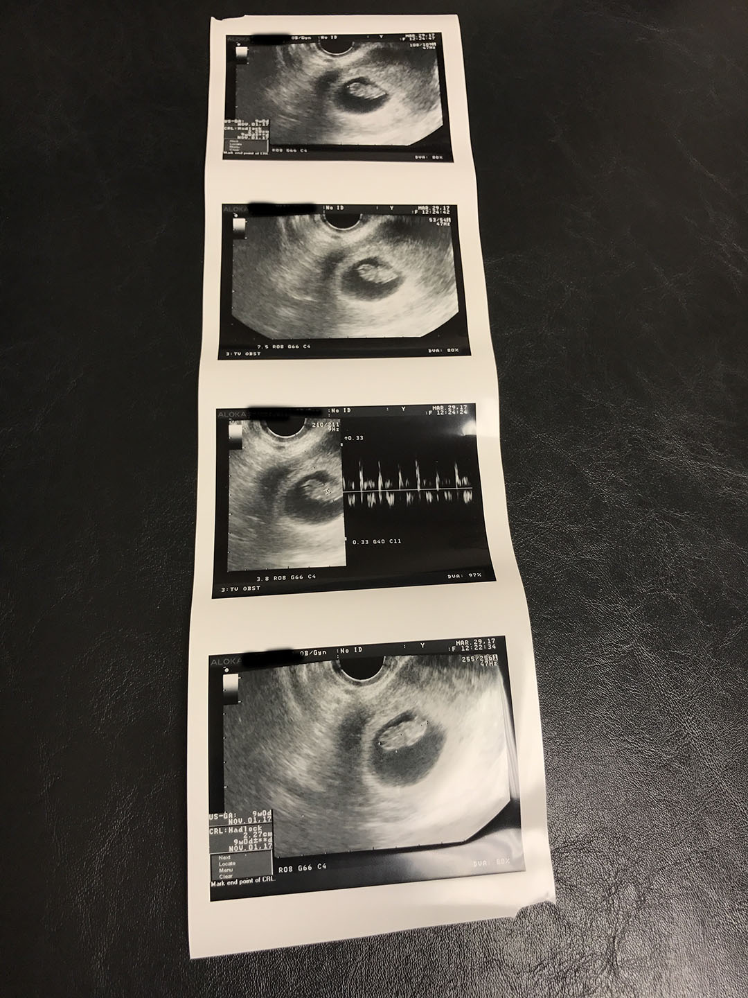 nine week old baby sonogram pictures heartbeat